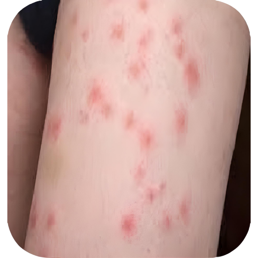 Don’t Let the Bed Bugs BiteDon’t Let the Bed Bugs Bite! Complete Bed Bugs Control Guide | TPL Pest ControlDon’t Let the Bed Bugs Bite